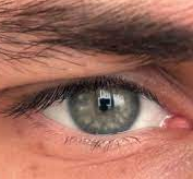 Eye.eye
